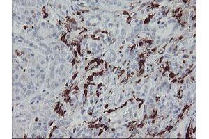 Image no. 10 for anti-Coagulation Factor XIII, A1 Polypeptide (F13A1) antibody (ABIN1498150)
