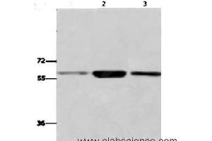 Western Blot analysis of K562,231,Human fetal liver tissue using GPC6 Polyclonal Antibody at dilution of 1:700 (Glypican 6 抗体)