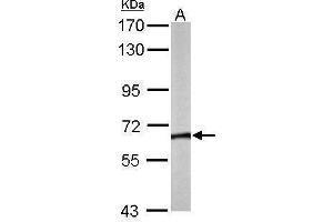 WB Image Sample (50 ug of whole cell lysate) A: Mouse brain 7. (CCT8 抗体)