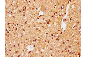 IHC image of ABIN7127752 diluted at 1:100 and staining in paraffin-embedded human brain tissue performed on a Leica BondTM system. (Recombinant SNCA 抗体  (pSer129))