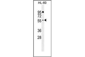 Western blot analysis of FBXW11 Antibody (Center) in HL-60 cell line lysates (35ug/lane).