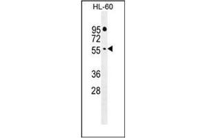 Western blot analysis of FBXW11 Antibody (Center) in HL-60 cell line lysates (35ug/lane). (FBXW11 抗体  (Middle Region))