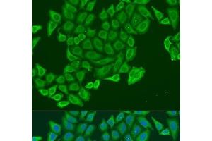 Immunofluorescence analysis of U2OS cells using EXOC2 Polyclonal Antibody at dilution of 1:100. (EXOC2 抗体)