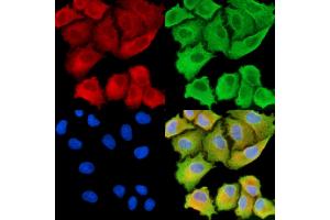 ABIN7094981 and ABIN7099037 staining  cells by IF/ICC. (ANKH 抗体)