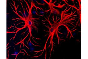 Mixed cultures of neurons and glia stained with chicken anti-GFAP (red), and DNA (blue). (GFAP 抗体)