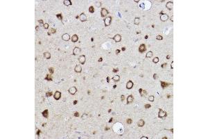 Immunohistochemistry of paraffin-embedded rat brain using CARS Rabbit mAb (ABIN7266624) at dilution of 1:100 (40x lens). (CARS 抗体)
