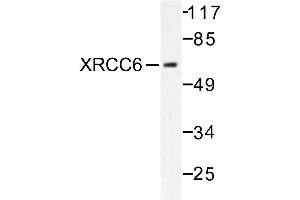 Image no. 1 for anti-X-Ray Repair Complementing Defective Repair in Chinese Hamster Cells 6 (XRCC6) antibody (ABIN271984) (XRCC6 抗体)