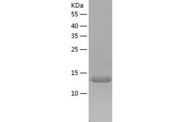 SNRPD3 Protein (AA 1-126) (His tag)