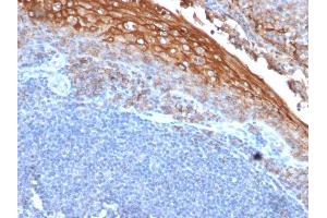 Formalin-fixed, paraffin-embedded human Tonsil stained with MUC18 Mouse Monoclonal Antibody (MUC18/1130). (MCAM 抗体)