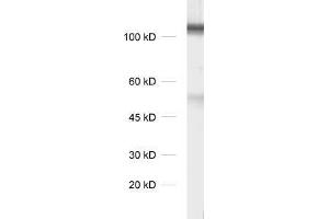 dilution 1 : 1000, sample: synaptic membrane fraction of rat brain (LP1) (DLG3 抗体)