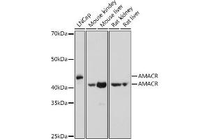 Western blot analysis of extracts of various cell lines, using AMACR antibody (ABIN3021497, ABIN3021498, ABIN3021499 and ABIN6215153) at 1:1000 dilution. (AMACR 抗体  (AA 1-198))