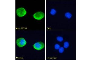 ABIN6391376 Immunofluorescence analysis of paraformaldehyde fixed A431 cells, permeabilized with 0.