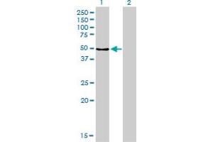 Western Blotting (WB) image for anti-Membrane Protein, Palmitoylated 1, 55kDa (MPP1) (AA 1-466) antibody (ABIN517999)