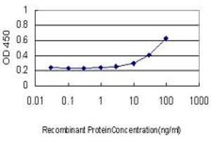 Detection limit for recombinant GST tagged PDK1 is approximately 3ng/ml as a capture antibody. (PDPK1 抗体  (AA 203-302))