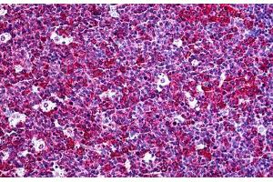 Human Tonsil: Formalin-Fixed, Paraffin-Embedded (FFPE) (CXCL5 抗体  (AA 1-115))