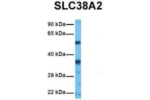 Host:  Rabbit  Target Name:  SLC38A2  Sample Tissue:  Human HepG2  Antibody Dilution:  1. (SLC38A2 抗体  (N-Term))