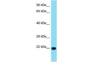 Host:  Rabbit  Target Name:  BTBD2  Sample Type:  Esophagus Tumor lysates  Antibody Dilution:  1. (BTBD2 抗体  (C-Term))