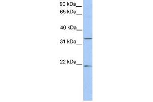 WB Suggested Anti-FUT6 Antibody Titration:  0. (FUT6 抗体  (C-Term))