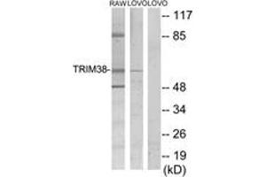 Western blot analysis of extracts from LOVO/RAW264. (TRIM38 抗体  (AA 161-210))