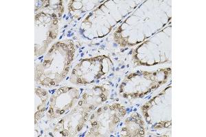 Immunohistochemistry of paraffin-embedded human stomach using MAPK1 antibody. (ERK2 抗体  (N-Term))