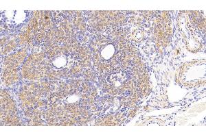 Detection of COX2 in Rat Ovary Tissue using Polyclonal Antibody to Cytochrome C Oxidase Subunit II (COX2)