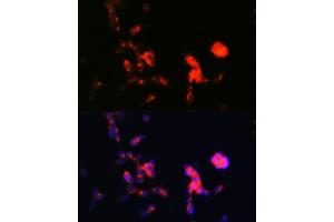 Immunofluorescence analysis of SH-SY5Y cells using DKK3 Rabbit mAb (ABIN1680063, ABIN3018243, ABIN3018244 and ABIN7101586) at dilution of 1:100 (40x lens). (DKK3 抗体)