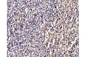 IHC analysis of MPPB/PMPCB using anti-MPPB/PMPCB antibody (ABIN7600758). (PMPCB 抗体  (AA 23-479))