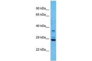 Western Blotting (WB) image for anti-Olfactory Receptor, Family 5, Subfamily V, Member 1 (OR5V1) (C-Term) antibody (ABIN2791750) (OR5V1 抗体  (C-Term))