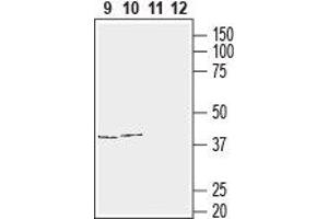 Western blot analysis of human T-cell leukemia (Jurkat) (lanes 9 and 11) and human neuroblastoma (SH-SY5Y) (lanes 10 and 12) cell line lysates:9,10.