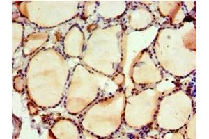 Immunohistochemistry of paraffin-embedded human thyroid tissue using ABIN7161554 at dilution of 1:100 (NAB2 抗体  (AA 1-200))