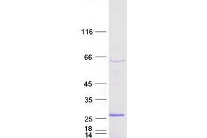 Western Blotting (WB) image for Synovial Sarcoma, X Breakpoint 3 (SSX3) (Transcript Variant 2) protein (Myc-DYKDDDDK Tag) (ABIN2733103)