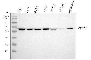 Western blot analysis of SQSTM1 using anti-SQSTM1 antibody (ABIN3043937).