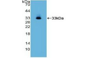 Detection of Recombinant ITGa2, Human using Polyclonal Antibody to Integrin Alpha 2 (ITGa2) (ITGA2 抗体  (AA 678-894))