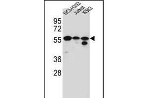 FOXN2 Antibody (N-term) (ABIN656184 and ABIN2845513) western blot analysis in NCI-,Jurkat,K562 cell line lysates (35 μg/lane). (FOXN2 抗体  (N-Term))