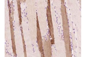 Paraformaldehyde-fixed, paraffin embedded Rat skeletal muscle Antigen retrieval by boiling in sodium citrate buffer (pH6. (Myoglobin 抗体  (AA 2-154))