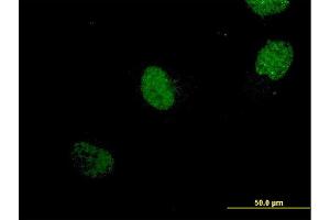 Immunofluorescence of monoclonal antibody to NEUROG1 on HeLa cell. (Neurogenin 1 抗体  (AA 82-163))