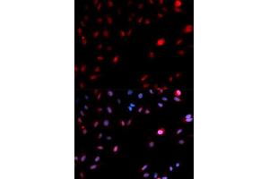 Immunofluorescence analysis of MCF-7 cells using Phospho-CDK1-Y15 antibody (ABIN5969877).