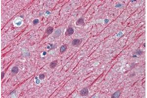 Human Brain, Cortex: Formalin-Fixed, Paraffin-Embedded (FFPE) (TUBB2A 抗体  (AA 1-446))