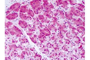 Anti-PRKD2 antibody IHC of human stomach. (PKD2 抗体  (Internal Region))