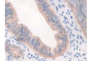 DAB staining on IHC-P; Samples: Mouse Uterus Tissue (CFP 抗体  (AA 54-217))