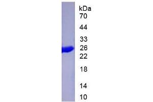 SDS-PAGE of Protein Standard from the Kit (Highly purified E. (Cytokeratin 19 ELISA 试剂盒)