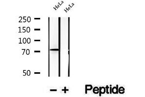 Western blot analysis of extracts of HeLa cells, using TBC1D23 antibody. (TBC1D23 抗体  (Internal Region))