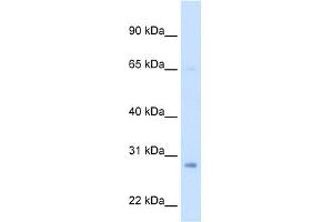 Western Blotting (WB) image for anti-Enoyl CoA Hydratase, Short Chain, 1, Mitochondrial (ECHS1) (Middle Region) antibody (ABIN2782326)