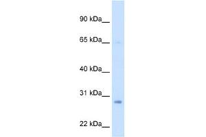 WB Suggested Anti-ECHS1 Antibody Titration:  2. (ECHS1 抗体  (Middle Region))