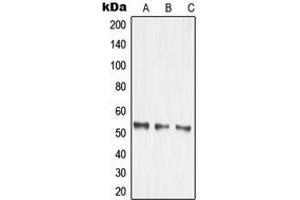 Western blot analysis of MMP14 expression in HEK293T (A), mouse kidney (B), rat brain (C) whole cell lysates. (MMP14 抗体  (Center))
