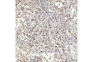 IHC analysis of U1A/SNRPA using anti-U1A/SNRPA antibody (ABIN7600891). (SNRPA1 抗体  (AA 25-218))