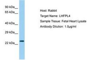 Image no. 1 for anti-Lipoma HMGIC Fusion Partner-Like 4 (LHFPL4) (AA 137-186) antibody (ABIN6750211) (LHFPL4 抗体  (AA 137-186))