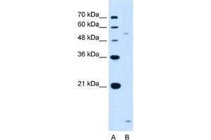 Western Blotting (WB) image for anti-ST3 beta-Galactoside alpha-2,3-Sialyltransferase 5 (ST3GAL5) antibody (ABIN2462977) (ST3GAL5 抗体)