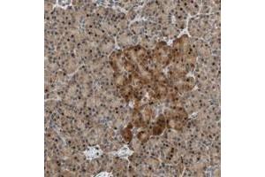 Immunohistochemical staining of human pancreas with HECW1 polyclonal antibody  shows strong nuclear and cytoplasmic positivity in exocrine glandular cells and islet cells at 1:20-1:50 dilution. (HECW1 抗体)