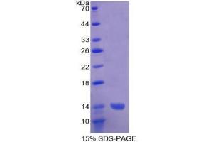 SDS-PAGE analysis of Human ADAMTS1 Protein. (ADAMTS1 蛋白)